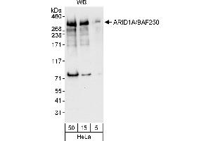 anti-AT Rich Interactive Domain 1A (SWI-Like) (ARID1A) (AA 675-725) antibody