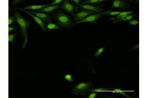 Immunofluorescence of purified MaxPab antibody to TRADD on HeLa cell. (TRADD 抗体  (AA 1-312))
