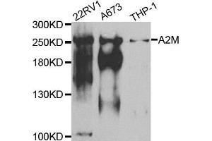 Western blot analysis of extracts of various cell lines, using A2M antibody. (alpha 2 Macroglobulin 抗体  (AA 1155-1474))