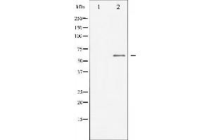 Western blot analysis of Dab1 expression in HepG2 whole cell lysates,The lane on the left is treated with the antigen-specific peptide. (DAB1 抗体  (Internal Region))