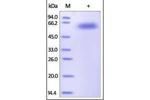 SDS-PAGE (SDS) image for Interleukin 2 Receptor, beta (IL2RB) (AA 27-239) (Active) protein (Fc Tag) (ABIN2181388)