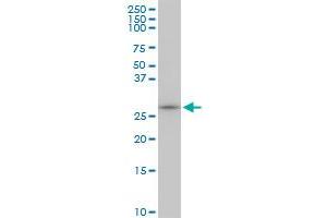 MAGEA12 monoclonal antibody (M01), clone 3A10. (MAGEA12 抗体  (AA 70-168))