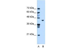 PGK1 antibody used at 1. (PGK1 抗体  (C-Term))