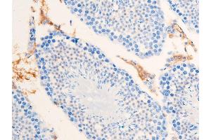 ABIN6267223 at 1/100 staining mouse testicular tissue sections by IHC-P. (CHEK1 抗体  (pSer301))