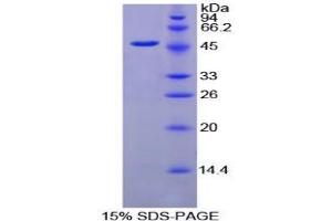 SDS-PAGE analysis of Chicken Fibrinogen gamma Protein. (FGG 蛋白)