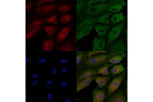 ABIN7094440 and ABIN7098488 staining  cells by IF/ICC. (Tenascin N 抗体  (C-Term))