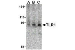 Western Blotting (WB) image for anti-Toll-Like Receptor 1 (TLR1) (N-Term) antibody (ABIN2479707) (TLR1 抗体  (N-Term))
