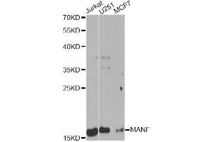 Western blot analysis of extracts of various cell lines, using MANF Antibody. (MANF 抗体  (AA 25-182))