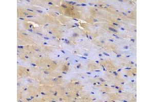 Immunohistochemistry of paraffin-embedded Mouse heart using SGCE Polyclonal Antibody at dilution of 1:200 (40x lens). (SGCE 抗体)