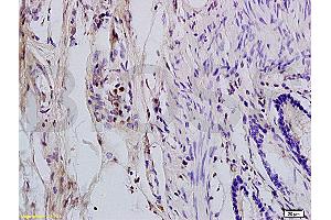 Immunohistochemistry (IHC) image for anti-Acidic (Leucine-Rich) Nuclear phosphoprotein 32 Family, Member C (ANP32C) (AA 81-180) antibody (ABIN759941)
