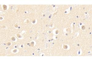 Detection of SKP1 in Human Cerebrum Tissue using Polyclonal Antibody to S-Phase Kinase Associated Protein 1 (SKP1) (SKP1 抗体  (AA 1-163))