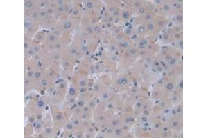 IHC-P analysis of Human Tissue, with DAB staining.