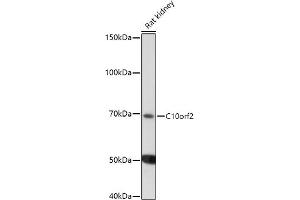 Western blot analysis of extracts of Rat kidney, using C10orf2 antibody (ABIN6129358, ABIN6137715, ABIN6137717 and ABIN6220923) at 1:1000 dilution. (C10orf2 抗体  (AA 385-684))