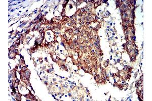 Immunohistochemistry (IHC) image for anti-Protein Kinase, AMP-Activated, alpha 2 Catalytic Subunit (PRKAA2) (AA 453-552) antibody (ABIN5611223)
