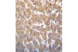 Immunohistochemistry analysis in formalin fixed and paraffin embedded human liver tissue reacted with JARID1A Antibody (C-term) followed which was peroxidase conjugated to the secondary antibody and followed by DAB staining. (KDM5A 抗体  (C-Term))