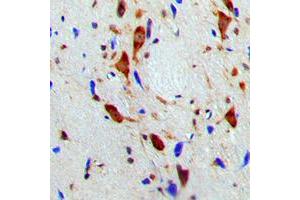 Immunohistochemical analysis of SMG7 staining in human brain formalin fixed paraffin embedded tissue section. (SMG7 抗体  (Center))