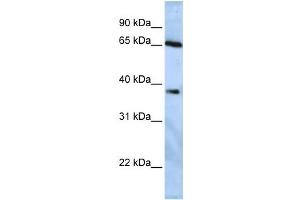 Western Blotting (WB) image for anti-Ubiquitin Specific Peptidase 3 (USP3) antibody (ABIN2458037) (USP3 抗体)