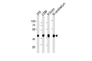 ALDOC Antibody (C-term) ABIN1882208 western blot analysis in 293,CEM cell line and mouse brain,cerebellum tissue lysates (35 μg/lane). (ALDOC 抗体)