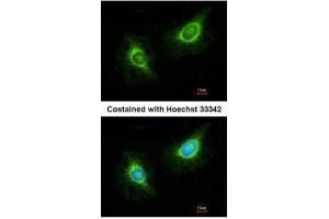 ICC/IF Image Immunofluorescence analysis of methanol-fixed HeLa, using Laminin beta 3, antibody at 1:200 dilution. (Laminin beta 3 抗体)