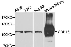Western blot analysis of extracts of various cell lines, using CDH16 antibody. (Cadherin-16 抗体)