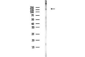 Western blot analysis of lysates from COLO205 cells(heat-shock,45 min treatment), using Phospho-IRS1 (Tyr612) Antibody at 1/1000 dilution.