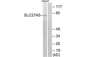 Western Blotting (WB) image for anti-Solute Carrier Family 27 (Fatty Acid Transporter), Member 5 (SLC27A5) (Internal Region) antibody (ABIN1850922) (SLC27A5 抗体  (Internal Region))