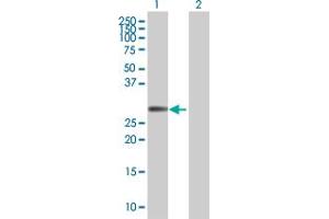 Western Blotting (WB) image for FHL1 293T Cell Transient Overexpression Lysate(Denatured) (ABIN1331833)