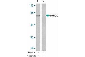 Western blot analysis of extract from MCF-7 cells using PRKCD polyclonal antibody  . (PKC delta 抗体)