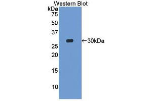 Western blot analysis of the recombinant protein. (MIB2 抗体  (AA 546-784))