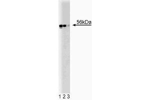Western blot analysis of Lyn on HEL (human erythroleukemia cell line) lysate.