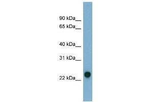 WB Suggested Anti-AK3 Antibody Titration: 0. (Adenylate Kinase 3 抗体  (N-Term))