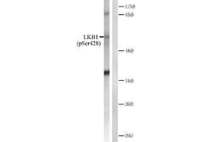 Western blot analysis of extracts from CV-1 cells treated with forsklin. (LKB1 抗体  (pSer428))