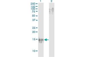 Western Blot analysis of APOB expression in transfected 293T cell line by APOB monoclonal antibody (M14), clone 3E5. (APOB 抗体  (AA 28-127))