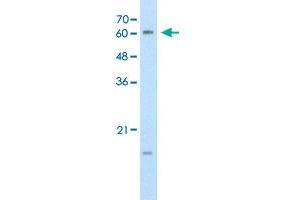 Western Blot analysis of Jurkat cell lysate with CYP4A22 polyclonal antibody  at 0. (CYP4A22 抗体  (N-Term))