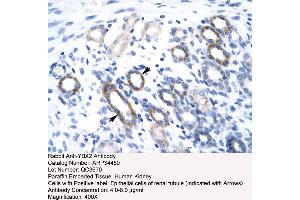 Human kidney (YBX2 抗体  (Middle Region))