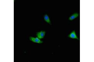 Immunofluorescent analysis of Hela cells using ABIN7150586 at dilution of 1:100 and Alexa Fluor 488-congugated AffiniPure Goat Anti-Rabbit IgG(H+L) (ALG12 抗体  (AA 367-422))