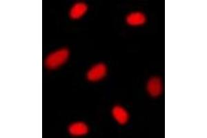 Immunofluorescence (IF) image for anti-O6-Methylguanine-DNA-Methyltransferase (MGMT) (N-Term) antibody (ABIN7303828)