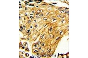 Immunohistochemistry (Paraffin-embedded Sections) (IHC (p)) image for anti-Interferon gamma Receptor 2 (Interferon gamma Transducer 1) (IFNGR2) (AA 308-337), (C-Term) antibody (ABIN652277)