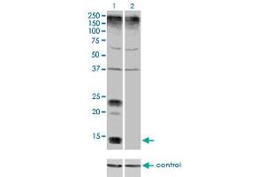 Western blot analysis of KCNE1 over-expressed 293 cell line, cotransfected with KCNE1 Validated Chimera RNAi (Lane 2) or non-transfected control (Lane 1).