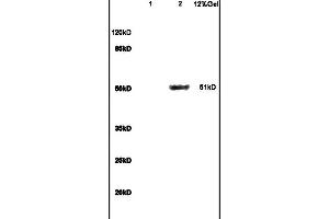 Lane 1: mouse brain lysates Lane 2: mouse liver lysates probed with Anti GCK/Glucokinase Polyclonal Antibody, Unconjugated (ABIN734558) at 1:200 in 4C. (GCK 抗体  (AA 101-200))