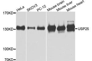 Western blot analysis of extracts of various cells, using USP25 antibody. (USP25 抗体)