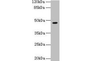 Western blot All lanes: NXF5 antibody at 4 μg/mL + HL60 whole cell lysate Secondary Goat polyclonal to rabbit IgG at 1/10000 dilution Predicted band size: 46, 43, 20, 36, 35 kDa Observed band size: 46 kDa (NXF5 抗体  (AA 1-200))