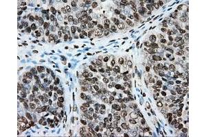 Immunohistochemical staining of paraffin-embedded colon tissue using anti-CYP1A2 mouse monoclonal antibody. (CYP1A2 抗体)