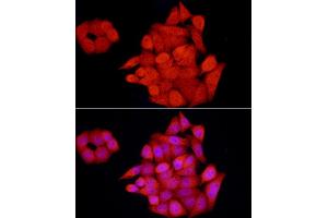 Immunofluorescence analysis of HeLa cells using GCH1 Rabbit pAb (ABIN7267525) at dilution of 1:100 (40x lens). (GCH1 抗体  (AA 1-250))