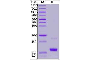 Human CCL19 / MIP-3 beta, Tag Free on  under reducing (R) condition. (CCL19 Protein (AA 22-98))