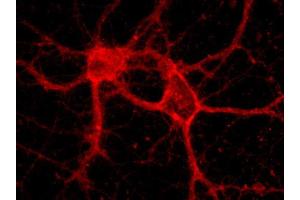 Indirect immunolabeling of hippocampus neurons (dilution 1 : 500) (Alpha-Protocadherin (AA 796-946) 抗体)