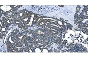 IHC analysis of eRF1/ETF1 using anti-eRF1/ETF1 antibody (ABIN7602625).