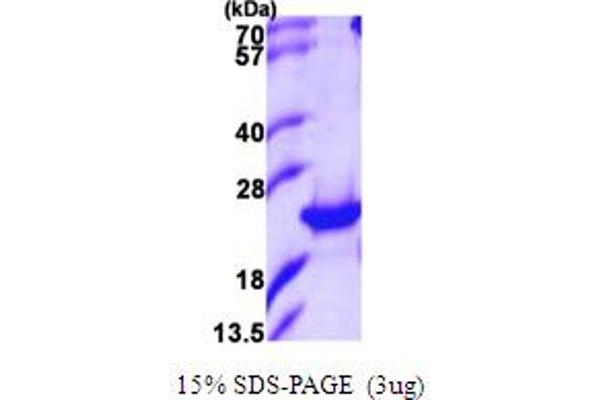 PTGES2 Protein (AA 1-186) (His tag)