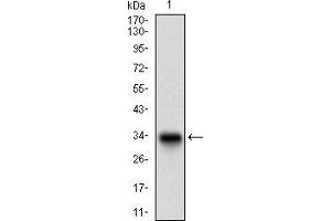 Western blot analysis using DCN mAb against human DCN recombinant protein. (Decorin 抗体  (AA 263-324))