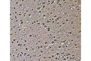 IHC analysis of VPS53 using anti-VPS53 antibody (ABIN7599731).